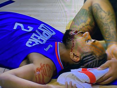 Vianočná NBA: Krvavý Leonard, dominantní Lakers aj Clippers, debakel Golden State